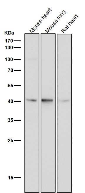 WB - Anti-CKII alpha CSNK2A1 Rabbit Monoclonal Antibody ABO14023